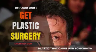 Sylvester Stallone's Transformation: Plastic Surgery Rumors Explored
