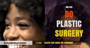 SZA's Transformation: Plastic Surgery Rumors and the Truth Behind Them