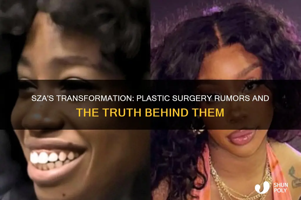 did sza do plastic surgery