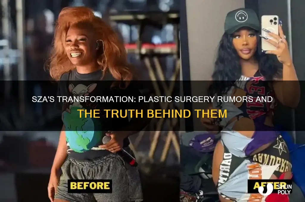 did sza get plastic surgey
