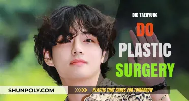 Did Taehyung Undergo Plastic Surgery? Unraveling the Truth Behind the Rumors