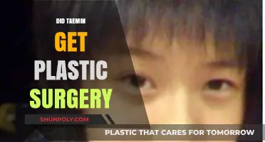 Taemin's Transformation: Uncovering the Truth About Plastic Surgery Rumors