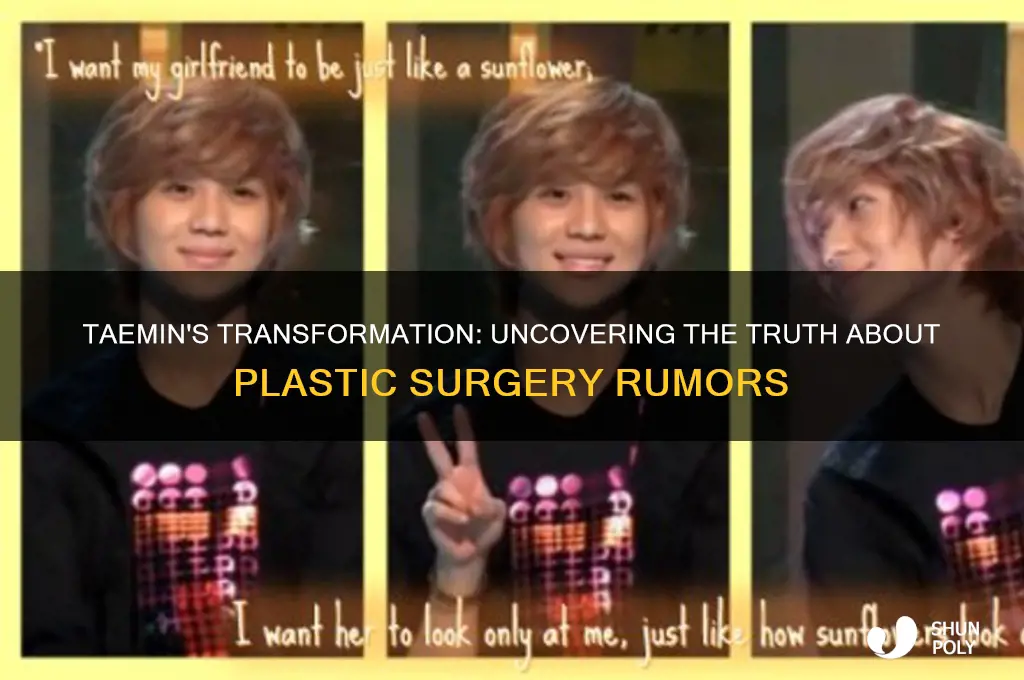 did taemin get plastic surgery