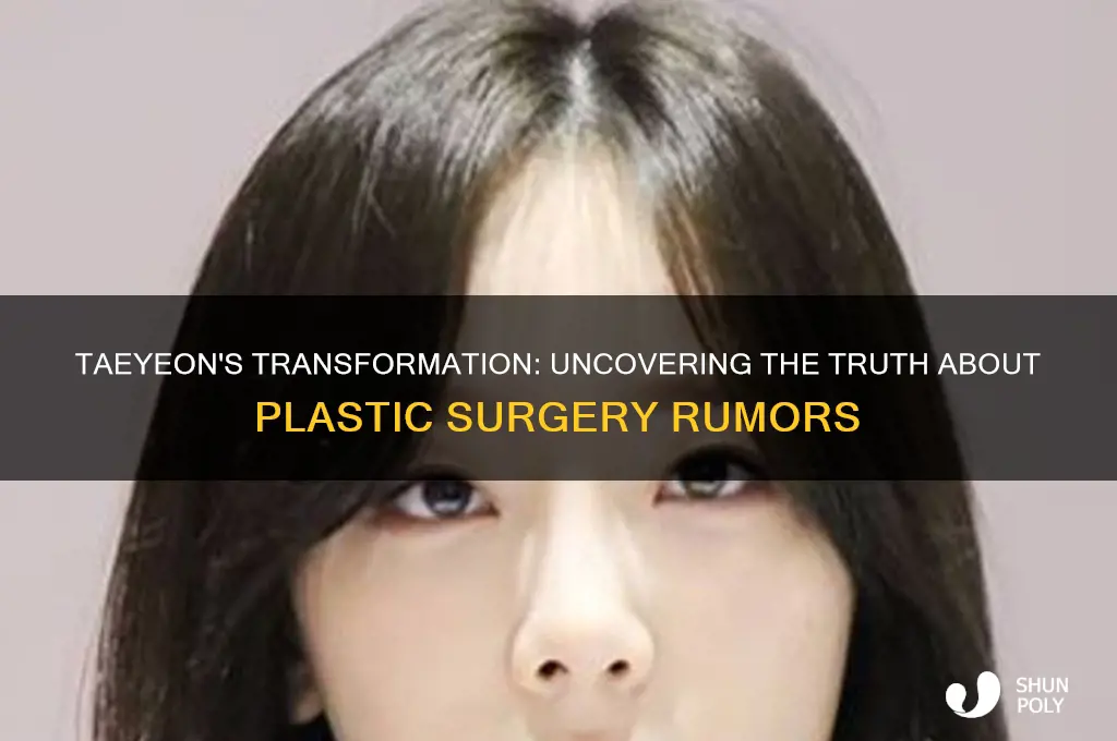 did taeyeon have plastic surgery