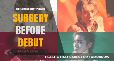 Taeyong's Pre-Debut Transformation: Plastic Surgery Rumors Explored