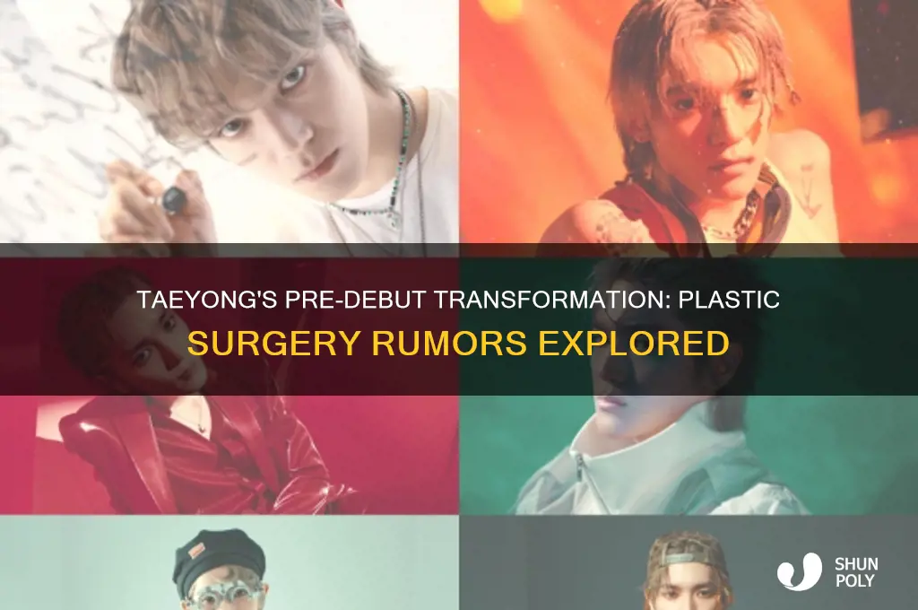 did taeyong have plastic surgery before debut