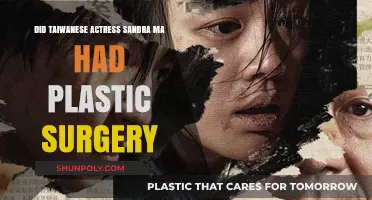 Sandra Ma's Transformation: Plastic Surgery Rumors Explored in Taiwan
