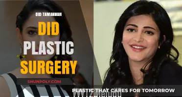 Tamannaah's Transformation: Unveiling the Truth About Plastic Surgery Rumors