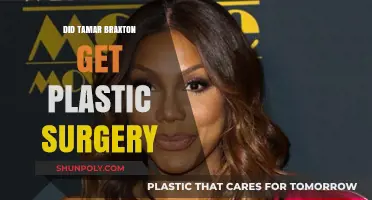 Did Tamar Braxton Undergo Plastic Surgery? Unveiling the Truth