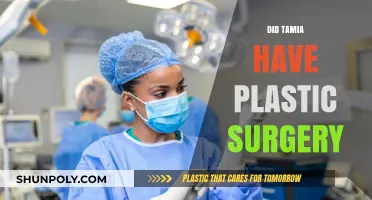 Did Tamia Undergo Plastic Surgery? Unveiling the Truth Behind Her Look