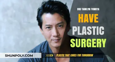 Tamlyn Tomita's Transformation: Plastic Surgery Rumors Explored