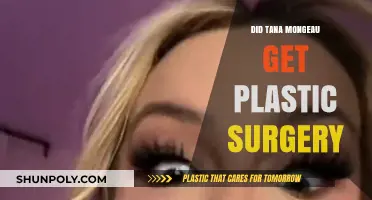 Tana Mongeau's Transformation: Plastic Surgery Rumors Explored