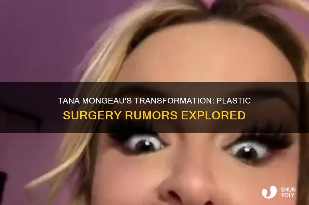 did tana mongeau get plastic surgery