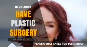 Tanya Roberts Plastic Surgery: Fact-Checking the Actress' Transformation