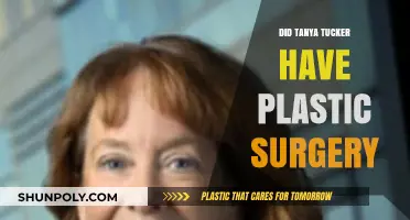 Tanya Tucker's Transformation: Plastic Surgery Speculations and Truths Revealed