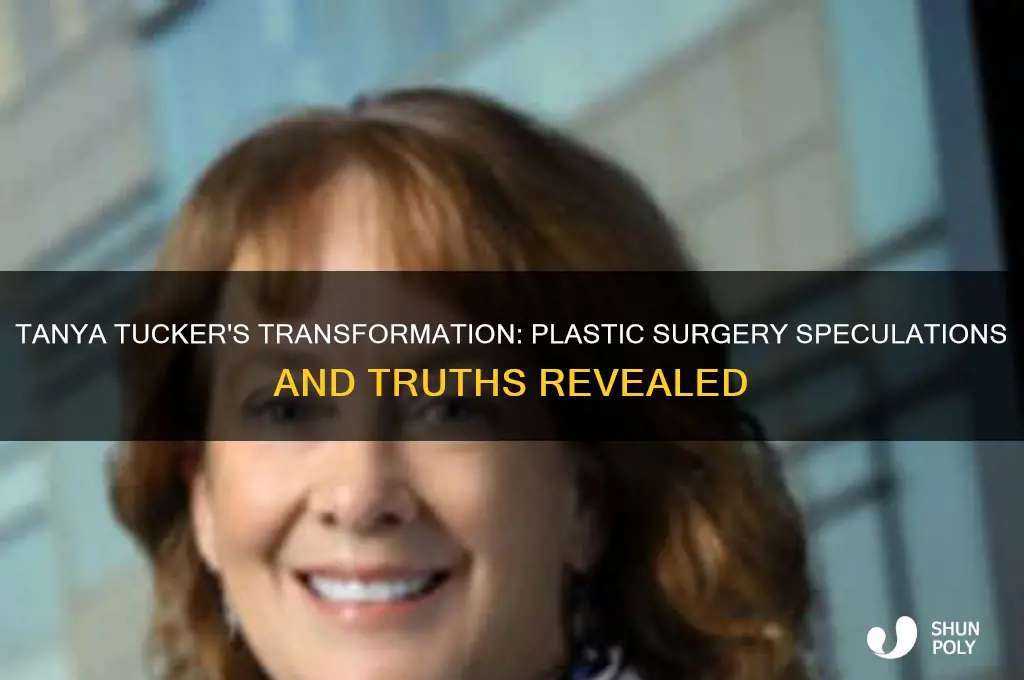 did tanya tucker have plastic surgery