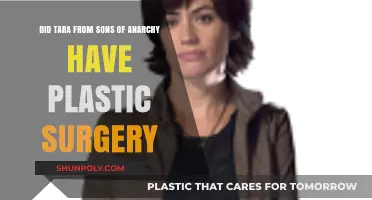 Tara's Transformation: Plastic Surgery Rumors in Sons of Anarchy
