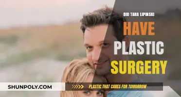 Tara Lipinski Plastic Surgery: Fact-Checking the Rumors and Speculations