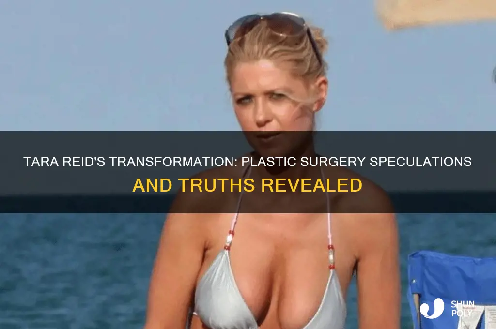 did tara reid have plastic surgery