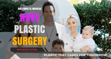 Tarek El Moussa's Transformation: Plastic Surgery Speculations Explored