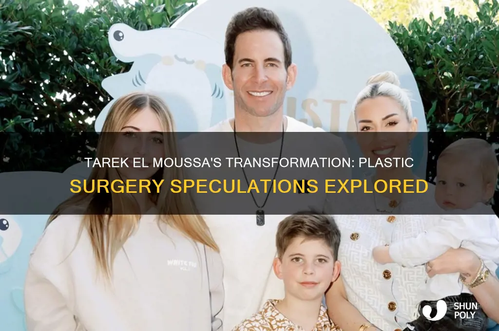 did tarek el moussa have plastic surgery