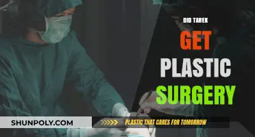 Did Tarek Undergo Plastic Surgery? Unveiling the Truth Behind His Look