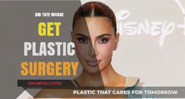 Tate McRae Plastic Surgery: Fact-Checking the Rumors and Speculations