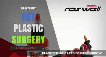 Did Tatu Baby Undergo Plastic Surgery? Unveiling the Truth