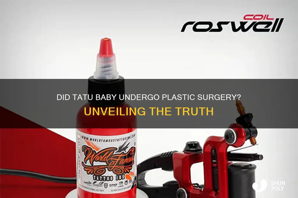 did tatu baby get plastic surgery