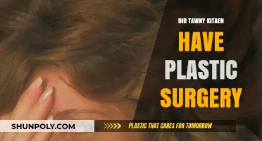Tawny Kitaen's Transformation: Unveiling the Truth About Plastic Surgery