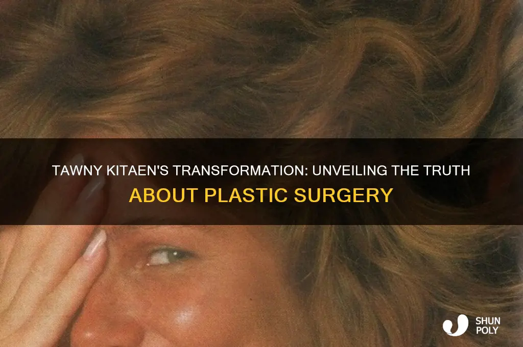 did tawny kitaen have plastic surgery