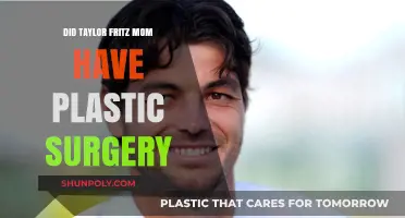 Taylor Fritz's Mom: Plastic Surgery Speculations and Truths Revealed