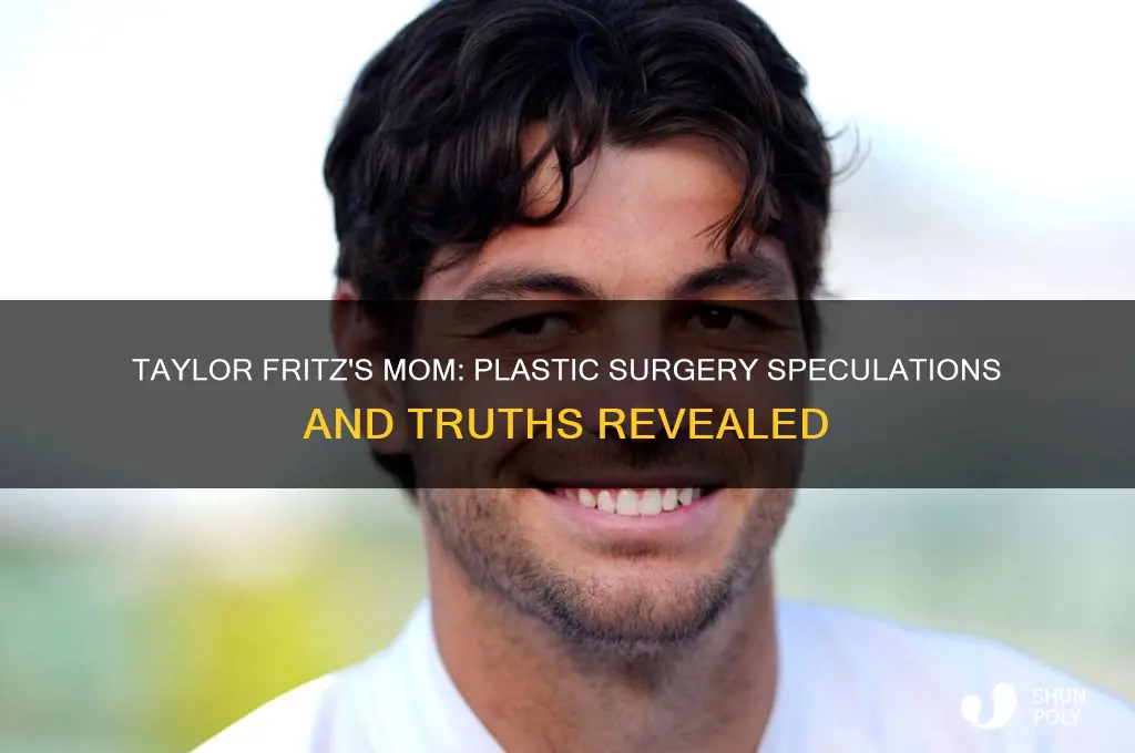 did taylor fritz mom have plastic surgery