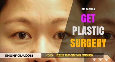 Did Tayshia Undergo Plastic Surgery? Unraveling the Transformation Truth