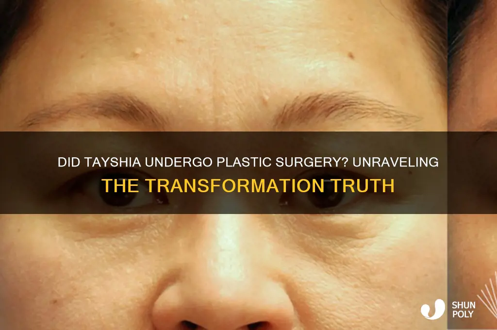 did tayshia get plastic surgery