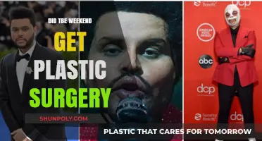 Did The Weeknd Undergo Plastic Surgery? Unveiling the Truth Behind His Look