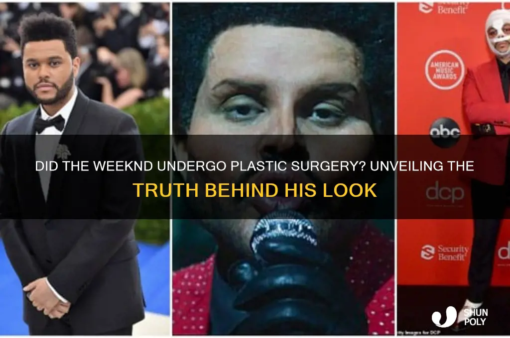 did tbe weekend get plastic surgery