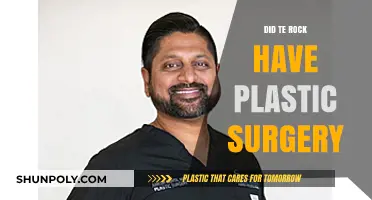 Did The Rock Undergo Plastic Surgery? Unveiling the Truth