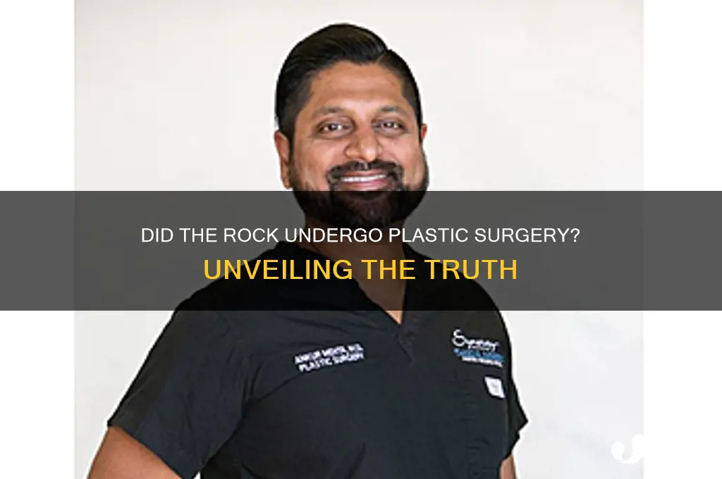did te rock have plastic surgery