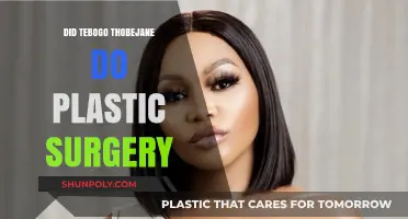 Tebogo Thobejane's Transformation: Plastic Surgery Rumors Explored