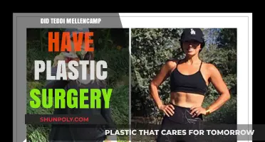 Teddi Mellencamp's Transformation: Plastic Surgery Rumors Explored