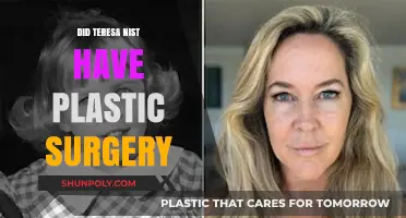 Teresa Nist Plastic Surgery: Fact-Checking the Rumors and Speculations