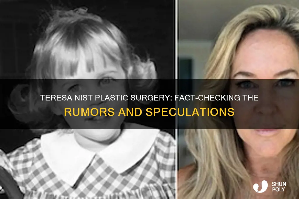 did teresa nist have plastic surgery