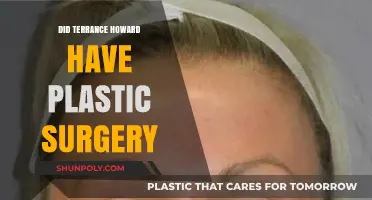 Terrance Howard's Transformation: Plastic Surgery Rumors Explored