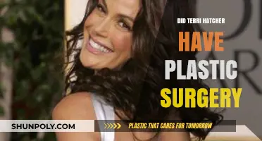 Terri Hatcher's Transformation: Plastic Surgery Rumors and Reality Revealed