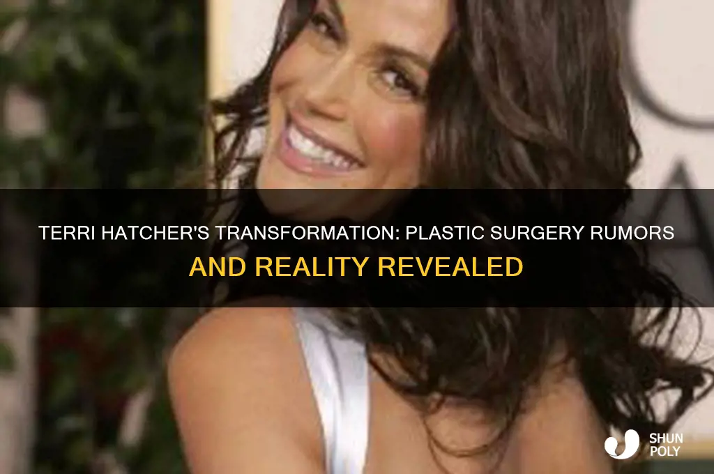 did terri hatcher have plastic surgery
