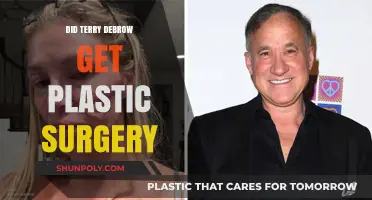 Terry Dubrow's Transformation: Plastic Surgery Speculations and Truths Revealed