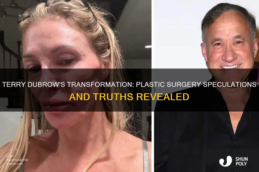 did terry debrow get plastic surgery