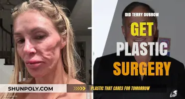 Terry Dubrow's Transformation: Plastic Surgery Rumors and Reality Revealed