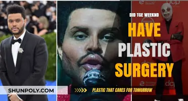 The Weeknd's Transformation: Plastic Surgery Rumors Explored and Debunked